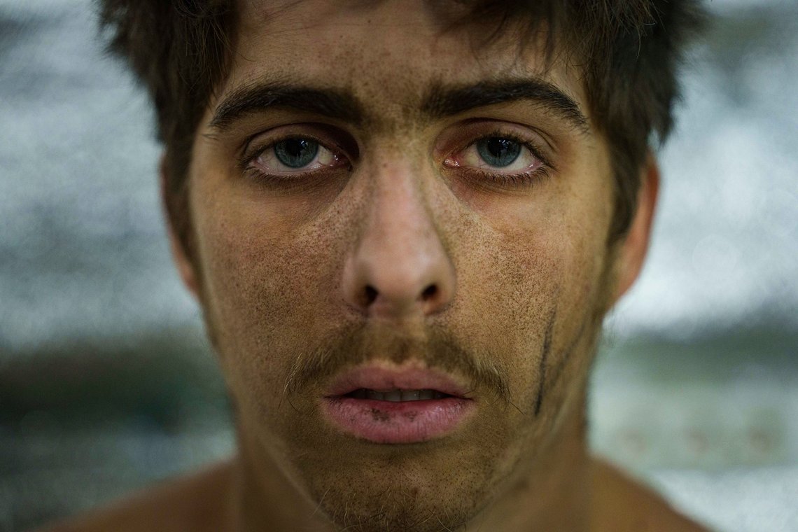 FILE - A shell-shocked Ukrainian soldier of the Azov brigade sits at the stabilization point after arriving from the front line, near Toretsk, Donetsk region, Ukraine, on Sept. 24, 2024. (AP Photo/Evgeniy Maloletka, File) FILE - A shell-shocked Ukrainian soldier of the Azov brigade sits at the stabilization point after arriving from the front line, near Toretsk, Donetsk region, Ukraine, on Sept. 24, 2024. (AP Photo/Evgeniy Maloletka, File)