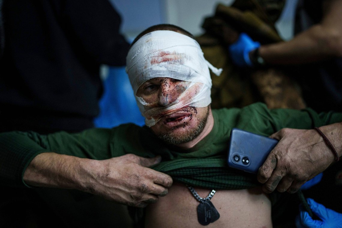 An injured Ukrainian serviceman takes off his shirt after arriving from the battlefield at Medical Service "Ulf" of the 108th Separate Battalion "Da Vinci Wolves" on Pokrovsk direction, Ukraine, Monday, Dec. 23, 2024. (AP Photo/Evgeniy Maloletka) An injured Ukrainian serviceman takes off his shirt after arriving from the battlefield at Medical Service "Ulf" of the 108th Separate Battalion "Da Vinci Wolves" on Pokrovsk direction, Ukraine, Monday, Dec. 23, 2024. (AP Photo/Evgeniy Maloletka)