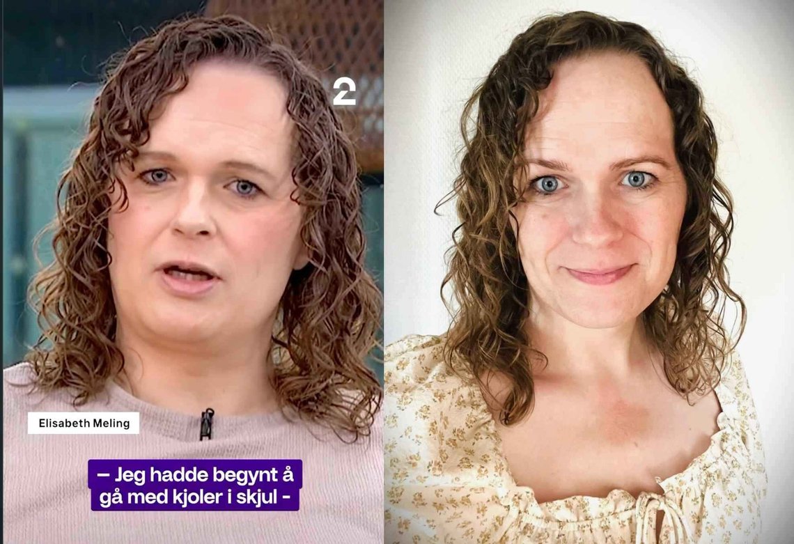 Newly elected leader of the Centre Party, Elisabeth Meling. Photo: Still from TV2 interview (left) and Centre Party/private (right) Newly elected leader of the Centre Party, Elisabeth Meling. Photo: Still from TV2 interview (left) and Centre Party/private (right)