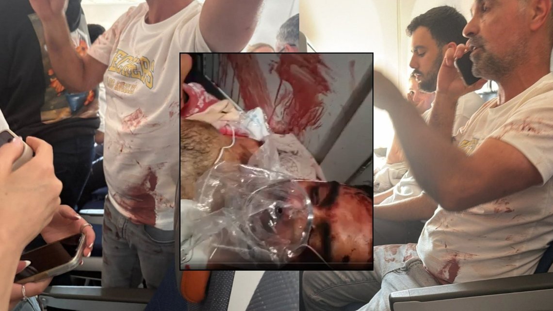 The co-pilot was seriously injured after the pilot attacked him with a knife. Passengers thwarted what was intended to be another 9/11. Photo: X. The co-pilot was seriously injured after the pilot attacked him with a knife. Passengers thwarted what was intended to be another 9/11. Photo: X.