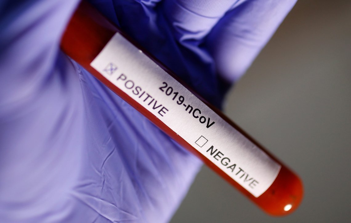 Test tube with Corona virus name label is seen in this illustration taken on January 29, 2020. REUTERS/Dado Ruvic Test tube with Corona virus name label is seen in this illustration taken on January 29, 2020. REUTERS/Dado Ruvic