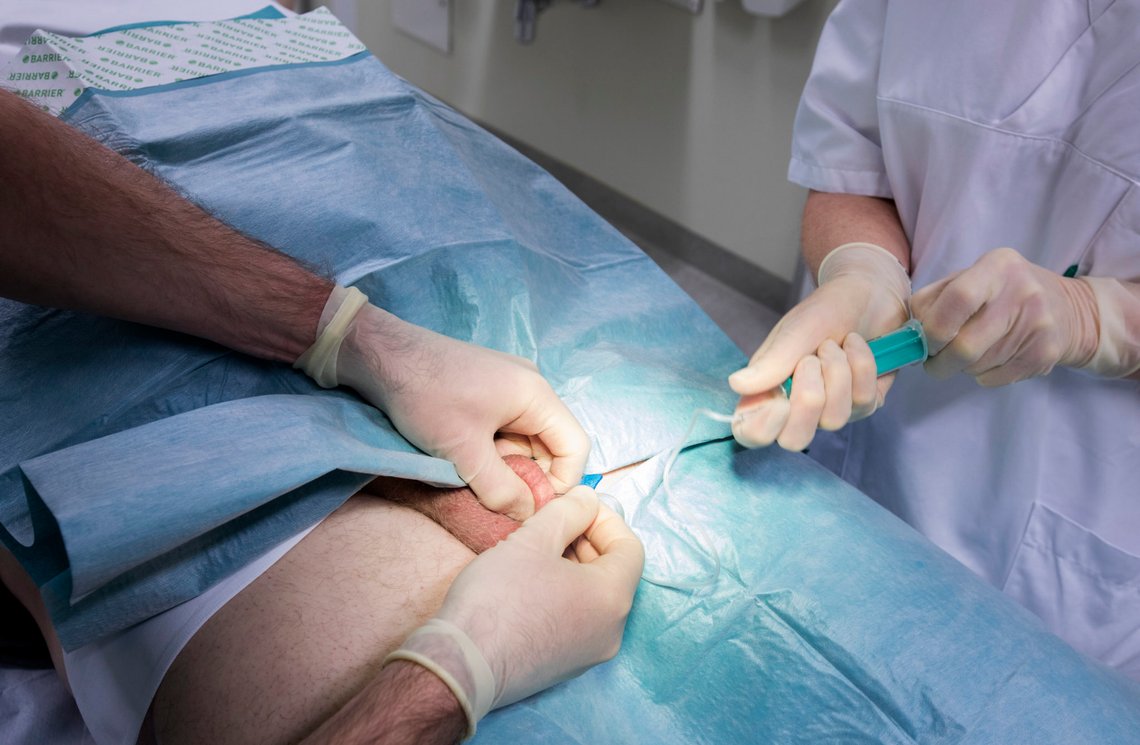 TRONDHEIM 20170308.
Uthenting av sædceller fra testikkel. Utredning og behandling med assistert befruktning på Fertilitetsseksjonen ved St. Olavs Hospital Universitetssykehuset i Trondheim
Modellklarert til redaksjonell bruk.
Foto: Gorm Kallestad / NTB scanpix TRONDHEIM 20170308.
Uthenting av sædceller fra testikkel. Utredning og behandling med assistert befruktning på Fertilitetsseksjonen ved St. Olavs Hospital Universitetssykehuset i Trondheim
Modellklarert til redaksjonell bruk.
Foto: Gorm Kallestad / NTB scanpix