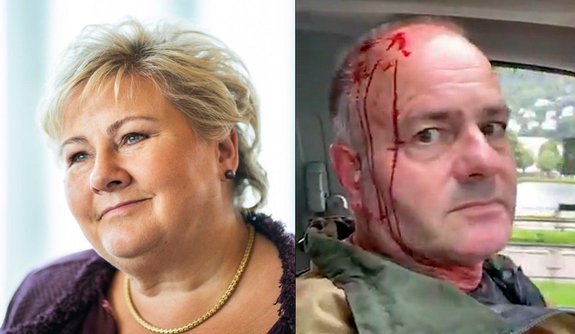 Foto av Erna Solberg: Håkon Mosvold Larsen / NTB scanpix
Fotomontasje av Document.no Foto av Erna Solberg: Håkon Mosvold Larsen / NTB scanpix
Fotomontasje av Document.no