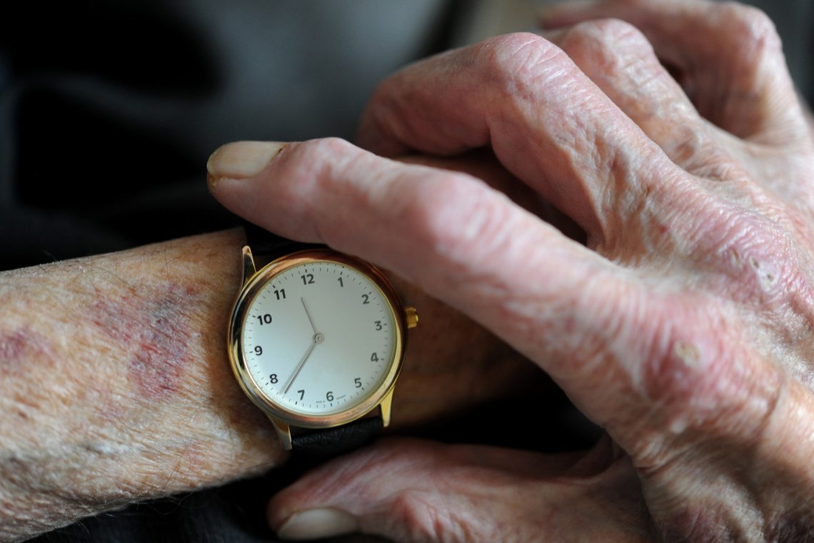 Gammel mann ser på armbåndsuret sitt. Klokke. Alderdom. Tiden går. Tiden flyr. Årene går. Blåmerke. Bli gammel. Eldes.
Senior is looking at his watch.
Foto: Frank May / NTB
NB! MODELLKLARERT Gammel mann ser på armbåndsuret sitt. Klokke. Alderdom. Tiden går. Tiden flyr. Årene går. Blåmerke. Bli gammel. Eldes.
Senior is looking at his watch.
Foto: Frank May / NTB
NB! MODELLKLARERT
