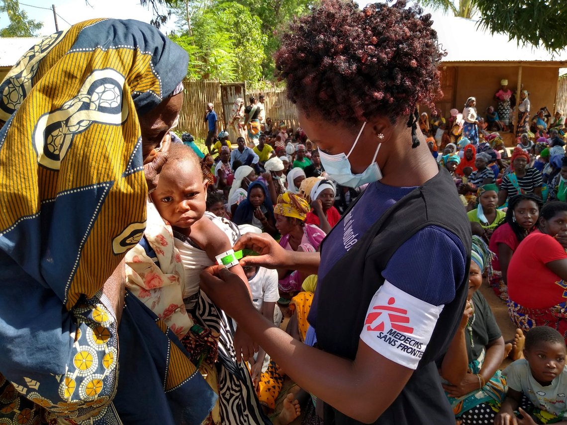 In this photo dated Friday Feb. 19, 2021, made available by Medecins Sans Frontieres, showing an MSF (Doctors Without Borders) staff member measuring a child's upper arm circumference to check for malnutrition in Meluco, in the northern Mozambican province of Cabo Delgado. Northern Mozambique's humanitarian crisis is quickly growing with more than 650 000 people displaced by the Islamic extremist insurgency in Cabo Delgado province according to a statement Tuesday March 16, 2021, from International aid groups. (AP Photo/MSF) In this photo dated Friday Feb. 19, 2021, made available by Medecins Sans Frontieres, showing an MSF (Doctors Without Borders) staff member measuring a child's upper arm circumference to check for malnutrition in Meluco, in the northern Mozambican province of Cabo Delgado. Northern Mozambique's humanitarian crisis is quickly growing with more than 650 000 people displaced by the Islamic extremist insurgency in Cabo Delgado province according to a statement Tuesday March 16, 2021, from International aid groups. (AP Photo/MSF)