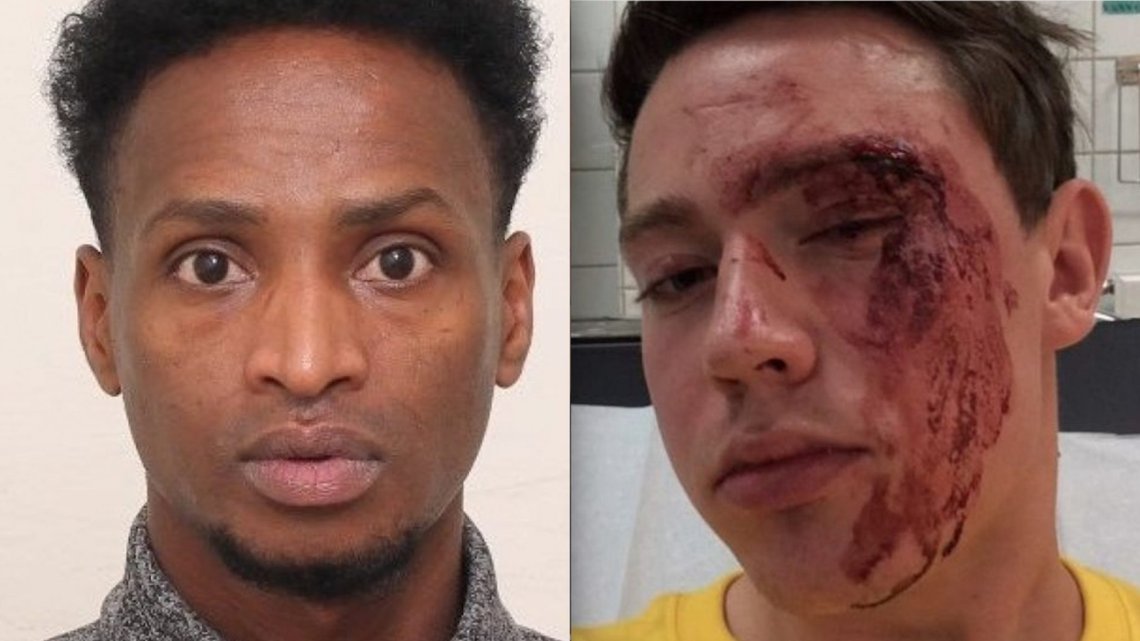 På rømmen: Abdirahman er 28 år, 171 cm høy og har en normalt slank kroppsbygning. Til høyre Edvin Eriksen, etter at han ble skallet ned av somalieren. Foto: Politiet og privat. På rømmen: Abdirahman er 28 år, 171 cm høy og har en normalt slank kroppsbygning. Til høyre Edvin Eriksen, etter at han ble skallet ned av somalieren. Foto: Politiet og privat.