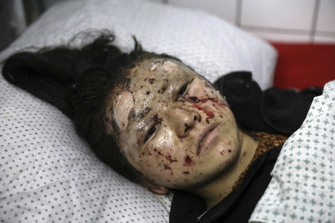 Stadig flere kvinner, jenter og gutter blir drept i Afghanistan. FN ber innstendig om at voldsbruken blir stanset og at Taliban-offensiven blir drevet tilbake. Foto: Rahmat Gul / AP / NTB Stadig flere kvinner, jenter og gutter blir drept i Afghanistan. FN ber innstendig om at voldsbruken blir stanset og at Taliban-offensiven blir drevet tilbake. Foto: Rahmat Gul / AP / NTB