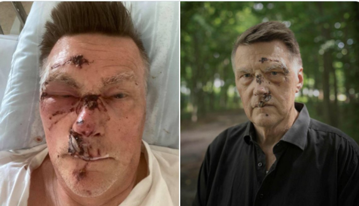 Jan Hörnlund og Bo Nilsson ble utsatt for et brutalt overfall og ran. Skjermdump Twitter/ Granskning Jan Hörnlund og Bo Nilsson ble utsatt for et brutalt overfall og ran. Skjermdump Twitter/ Granskning