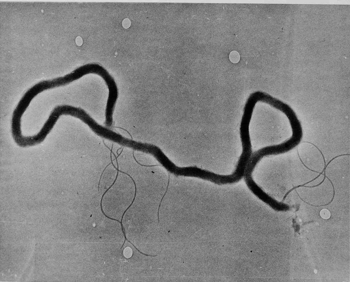 The organism treponema palladium, which causes syphilis, is seen through an electron microscope, May 23, 1944. (AP Photo) The organism treponema palladium, which causes syphilis, is seen through an electron microscope, May 23, 1944. (AP Photo)