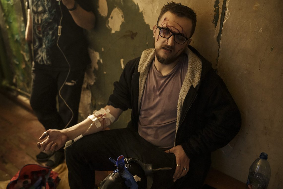 Vadim Krikun is treated in the hallway of his apartment building after a Russian attack in Kharkiv, Ukraine, Friday, April 15, 2022. (AP Photo/Felipe Dana) Vadim Krikun is treated in the hallway of his apartment building after a Russian attack in Kharkiv, Ukraine, Friday, April 15, 2022. (AP Photo/Felipe Dana)