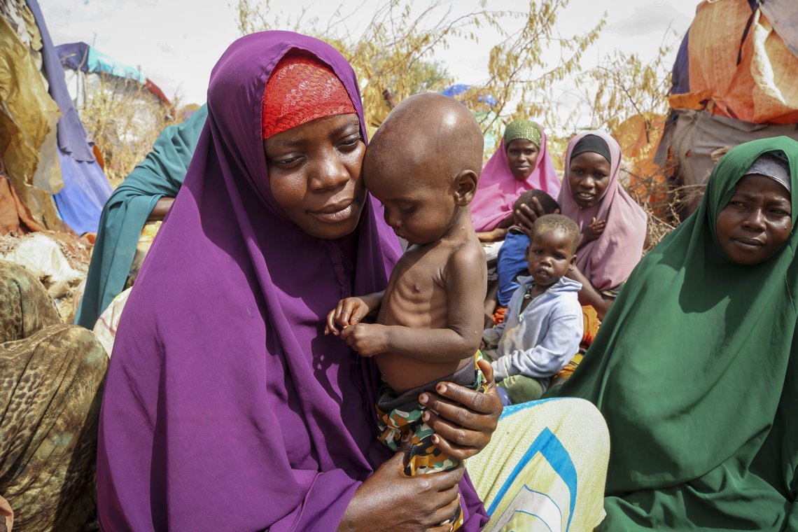 Nunay Mohamed, 25, who fled the drought-stricken Lower Shabelle area, holds her one-year old malnourished child at a makeshift camp for the displaced on the outskirts of Mogadishu, Somalia Thursday, June 30, 2022. The war in Ukraine has abruptly drawn millions of dollars away from longer-running humanitarian crises and Somalia is perhaps the most vulnerable as thousands die of hunger amid the driest drought in decades. (AP Photo/Farah Abdi Warsameh) Nunay Mohamed, 25, who fled the drought-stricken Lower Shabelle area, holds her one-year old malnourished child at a makeshift camp for the displaced on the outskirts of Mogadishu, Somalia Thursday, June 30, 2022. The war in Ukraine has abruptly drawn millions of dollars away from longer-running humanitarian crises and Somalia is perhaps the most vulnerable as thousands die of hunger amid the driest drought in decades. (AP Photo/Farah Abdi Warsameh)