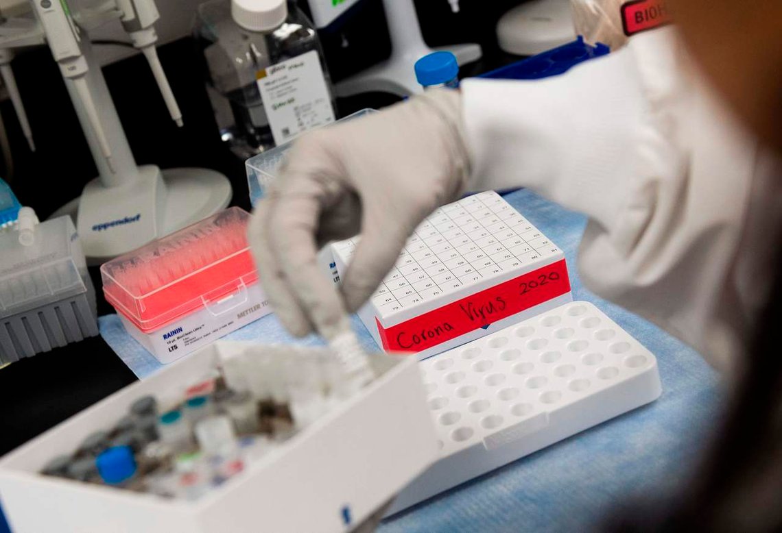 Kan Covid-19 ha oppstått på et lab i USA? Dette antyder en ny rapport publisert av The Lancet. Reaksjonene lot ikke vente på seg. Foto: ANDREW CABALLERO-REYNOLDS/ AFP/ NTB Kan Covid-19 ha oppstått på et lab i USA? Dette antyder en ny rapport publisert av The Lancet. Reaksjonene lot ikke vente på seg. Foto: ANDREW CABALLERO-REYNOLDS/ AFP/ NTB