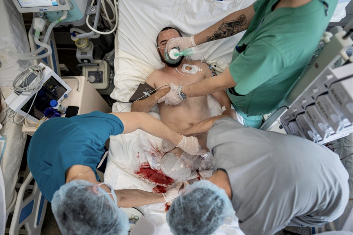 EDS NOTE: GRAPHIC CONTENT - Doctors perform Negative Pressure Wound Therapy to a Ukrainian serviceman with a high amputation of two legs at the ICU in Mechnikov hospital in Dnipro, Ukraine, Saturday, July 15, 2023. A surge of wounded soldiers has coincided with the major counteroffensive Ukraine launched last month to try to recapture its land from Russian forces. Surgeons at Mechnikov Hospital, one of the country's biggest, are busier now than perhaps at any other time since Russia began its invasion 17 months ago. (AP Photo/Evgeniy Maloletka) EDS NOTE: GRAPHIC CONTENT - Doctors perform Negative Pressure Wound Therapy to a Ukrainian serviceman with a high amputation of two legs at the ICU in Mechnikov hospital in Dnipro, Ukraine, Saturday, July 15, 2023. A surge of wounded soldiers has coincided with the major counteroffensive Ukraine launched last month to try to recapture its land from Russian forces. Surgeons at Mechnikov Hospital, one of the country's biggest, are busier now than perhaps at any other time since Russia began its invasion 17 months ago. (AP Photo/Evgeniy Maloletka)