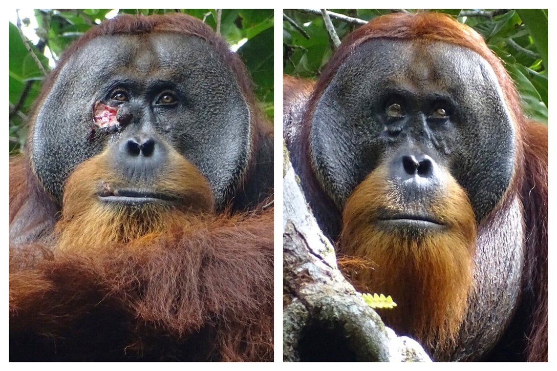 Bildene viser orangutangen Rakus, først med sår og så uten, etter at han påførte saft fra en plante kjent for å ha medisinsk virkning. Foto: Armas, Safruddin / Suaq Foundation via AP / NTB Bildene viser orangutangen Rakus, først med sår og så uten, etter at han påførte saft fra en plante kjent for å ha medisinsk virkning. Foto: Armas, Safruddin / Suaq Foundation via AP / NTB