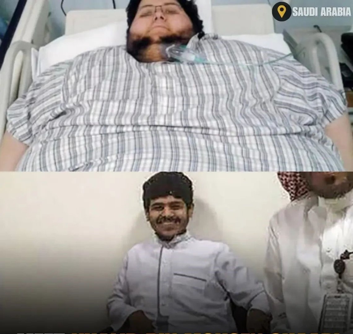 En heller uvirkelig transformasjon. 542 kilo slanket vekk. Foto: Ontime En heller uvirkelig transformasjon. 542 kilo slanket vekk. Foto: Ontime
