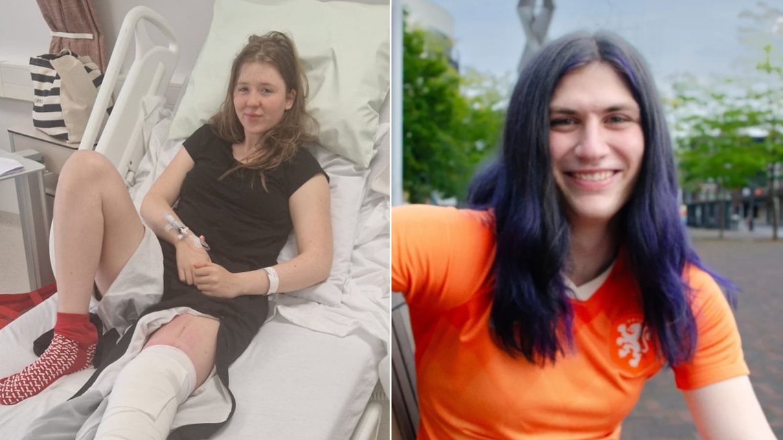 ØDELAGT: Elena King (20) fikk kneet ødelagt av transkvinnen Liam "Ashley" Mooney i en rugbykamp. Hun mener det hele burde vært unngått. Foto: Elena's Pretty Little Knee og X ØDELAGT: Elena King (20) fikk kneet ødelagt av transkvinnen Liam "Ashley" Mooney i en rugbykamp. Hun mener det hele burde vært unngått. Foto: Elena's Pretty Little Knee og X