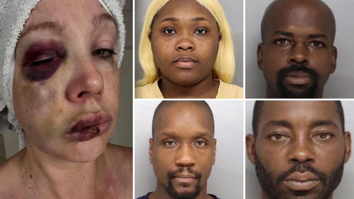 GRUSOMT: Den hvite alenemoren Holly ble utsatt for et grusomt overfall i et koordinert angrep av en svart mobb. Fire er arrestert. Foto: Hamilton County Sherrif's Office GRUSOMT: Den hvite alenemoren Holly ble utsatt for et grusomt overfall i et koordinert angrep av en svart mobb. Fire er arrestert. Foto: Hamilton County Sherrif's Office