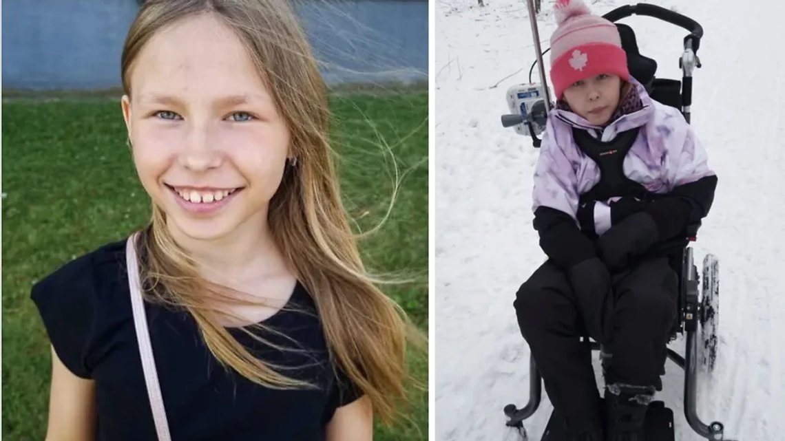 Luna fra Skellefteå, før og etter overfallet. Foto: Privat. Luna fra Skellefteå, før og etter overfallet. Foto: Privat.