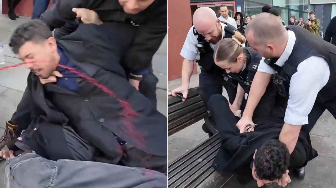Kameramannen Will Coleshill ble angrepet brutalt mens han forsøkte å holde igjen gjerningsmannen som gikk til angrep på aktivistene. Foto: Freedom Watch GB Kameramannen Will Coleshill ble angrepet brutalt mens han forsøkte å holde igjen gjerningsmannen som gikk til angrep på aktivistene. Foto: Freedom Watch GB