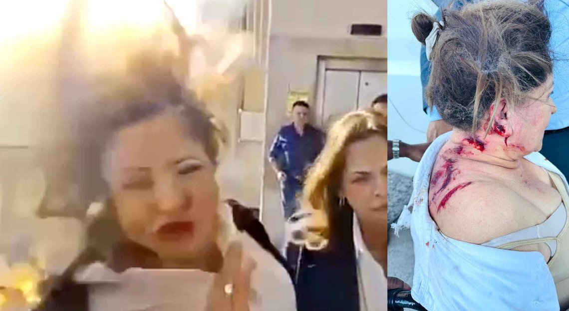 Kongresspolitiker Gladis Aurora López fikk en flyvende sprengladning i nakken i Honduras' hovedstad Tegucigalpa torsdag. (Videostillbilde: @Rodriguezshr/X) Kongresspolitiker Gladis Aurora López fikk en flyvende sprengladning i nakken i Honduras' hovedstad Tegucigalpa torsdag. (Videostillbilde: @Rodriguezshr/X)
