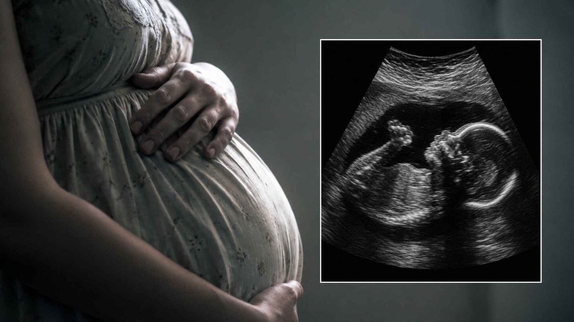 Surrogatmoren ble saksøkt etter hun nektet å abortere gutten. Han er nå to år, og lever i det homofile parets omsorg. Foto: Illustrasjonsbilde Surrogatmoren ble saksøkt etter hun nektet å abortere gutten. Han er nå to år, og lever i det homofile parets omsorg. Foto: Illustrasjonsbilde