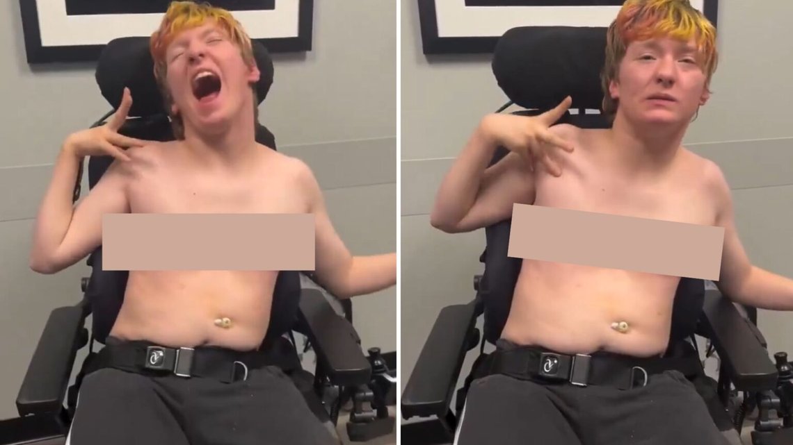 Videon av flickan Micah LeRoy som fått båda brösten borttagna skakar många i USA. Många anser att läkarna borde kastas i fängelse. Foto: Instagram Videon av flickan Micah LeRoy som fått båda brösten borttagna skakar många i USA. Många anser att läkarna borde kastas i fängelse. Foto: Instagram